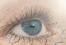 How to Get Relief from Dry Eyes