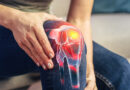 Your Knees: How to Keep Them in Shape